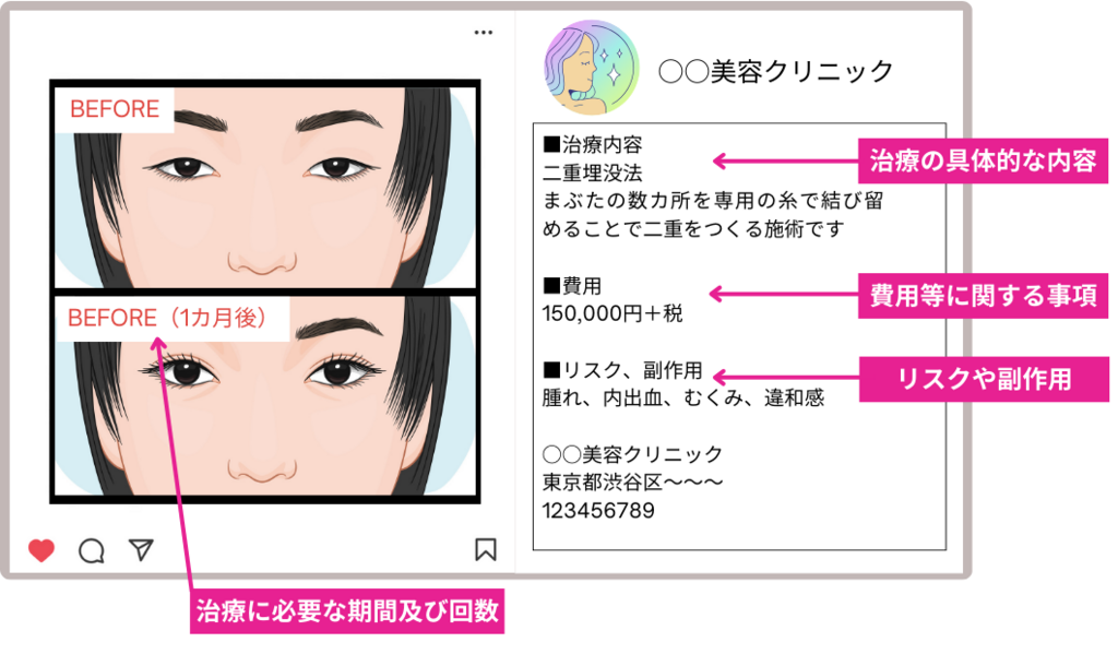 ビフォーアフター写真をインスタに乗せる際の４つのポイント